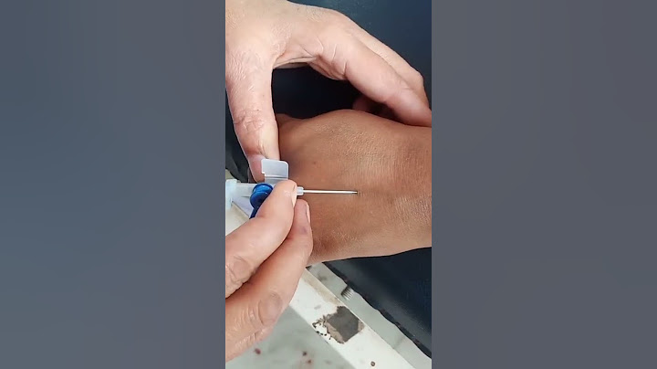 IV Cannula Insertion