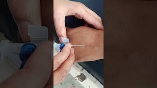 IV Cannula Insertion