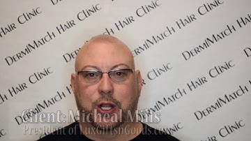 Testimonial - SMP on entire head by DermiMatch