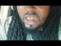 Custom Gold Grillz [Custom-Fit] 10k Solid Gold Deep Cut Grillz Review And Gold Tested