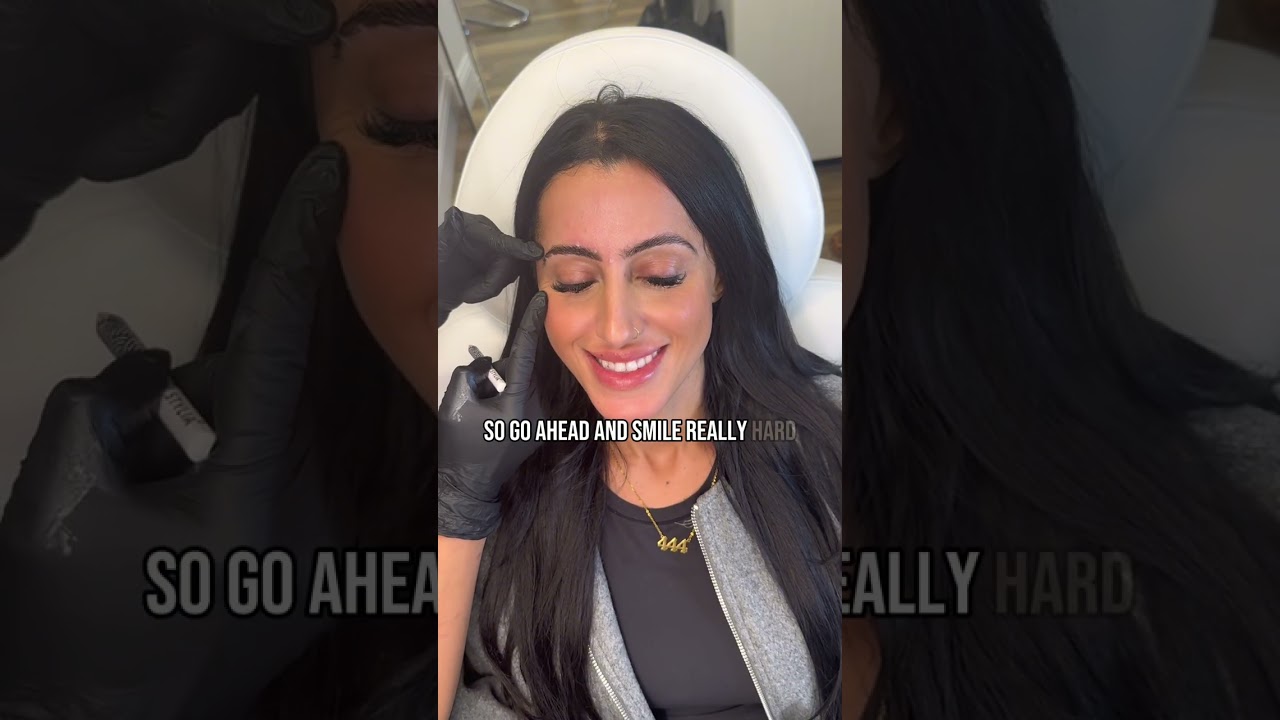 How I Do Botox in the Upper Face | Clai Araya’s Technique Revealed 👀✨