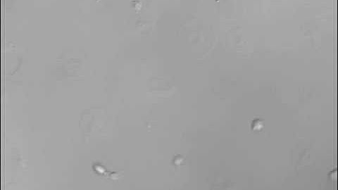 Platelet Adhesion and Spreading on a Fibrinogen Matrix