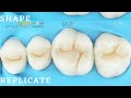 Lm arte posterior replica make occlusal modeling of posterior simple and easy ( replica technique)