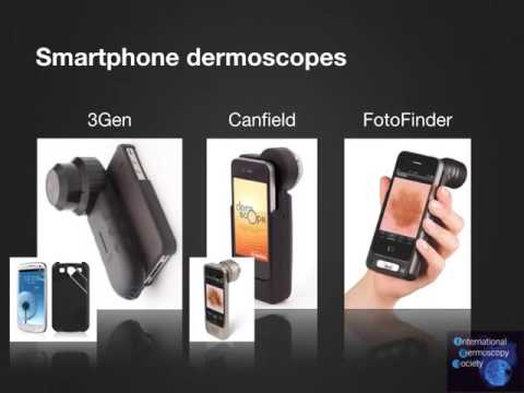 Smartphone teledermoscopy by Dr. John Paoli