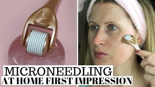 Microneedling At Home Demo & Review Flexi London Microneedler