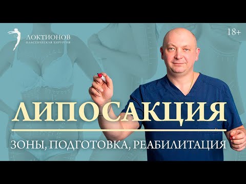 Виды липосакции и их сочетание с другими операциями // 18+