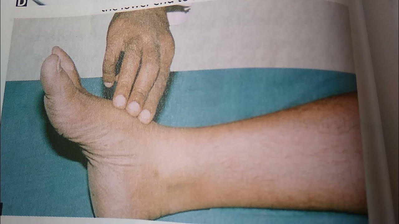 Medicine 083 b Dorsalis pedis artery pulse peripheral how to feel where