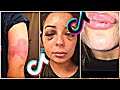 Abusive Relationships (Toxic Relationships) - Tik Tok Compilations