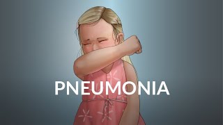 'Pneumonia' by Brian Fissel and Dr. Patricia Stoeck