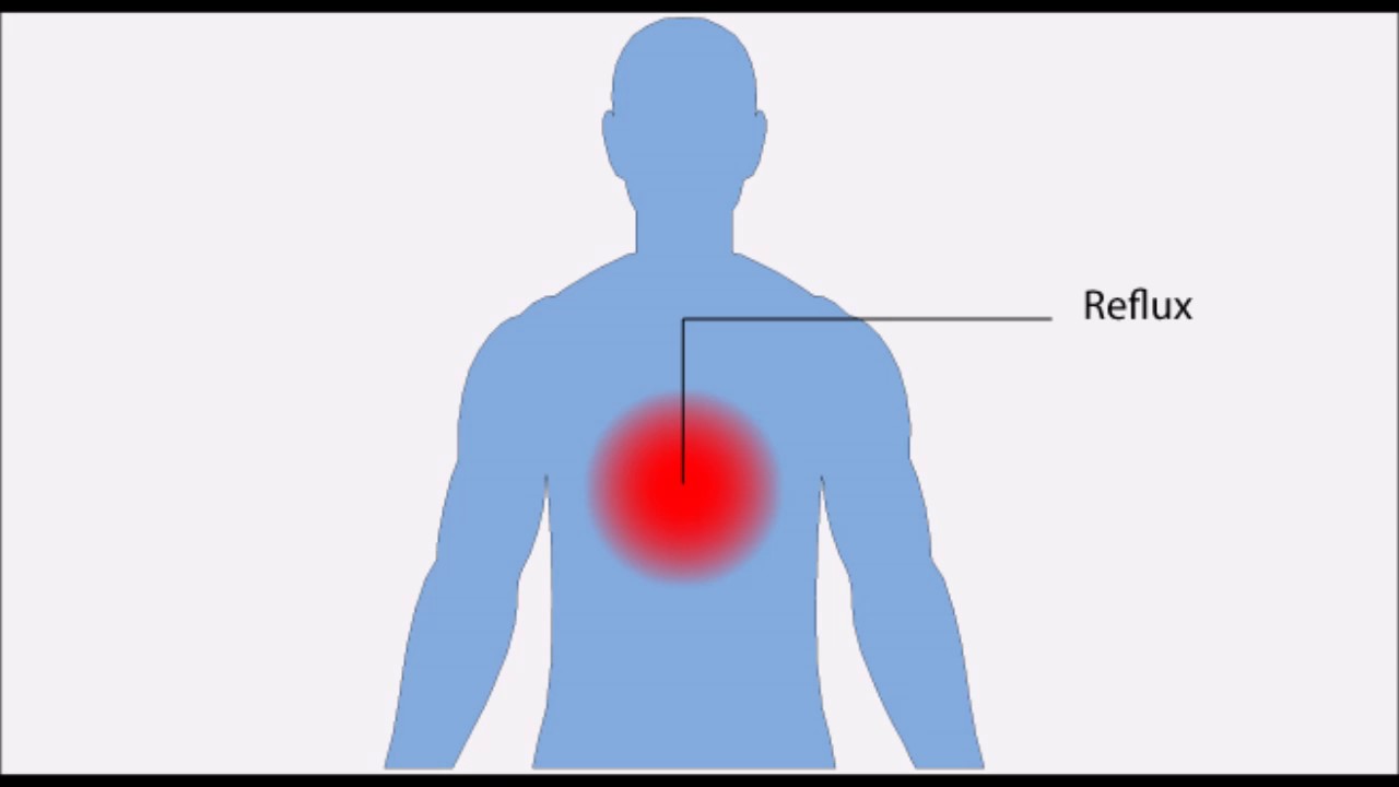 inflammation oesophage symptomes inflammation oesophage symptomes