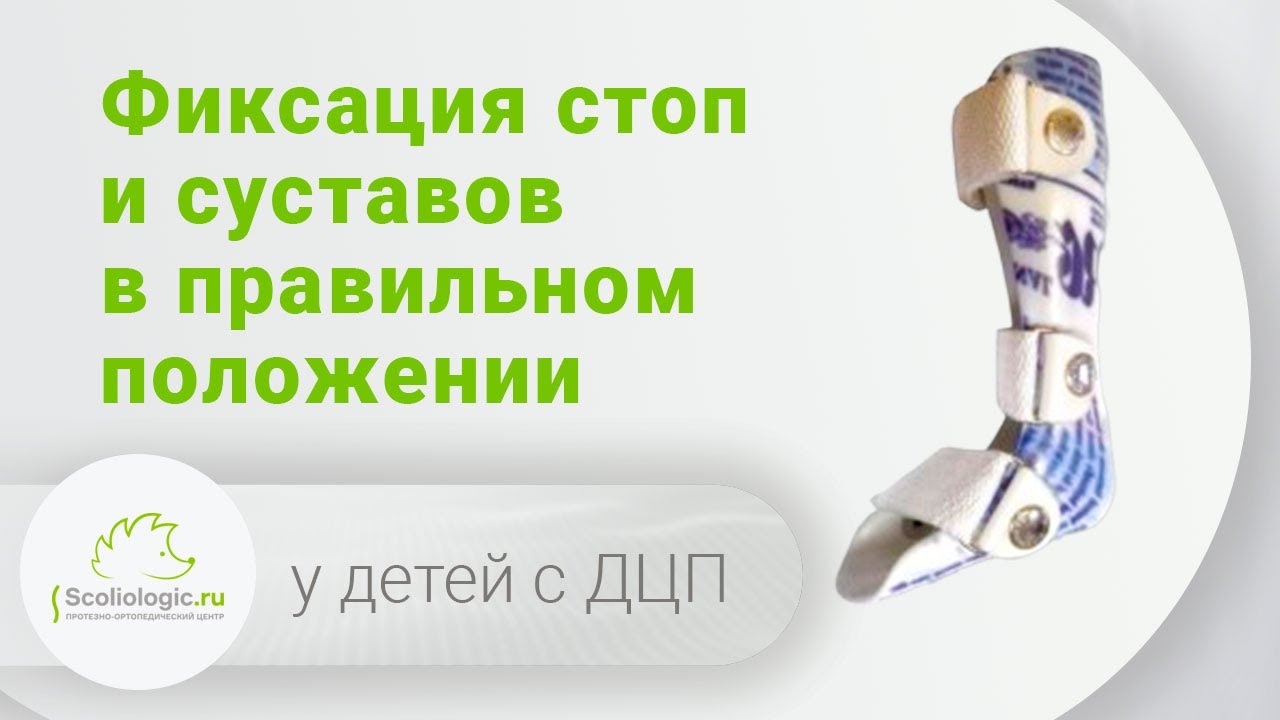 Тутор - аппарат для коррекции деформации. Фиксирует стопу и суставы в правильном положении.