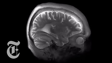 Mapping the Brain Down to .0001 Cubic Inches | The New York Times