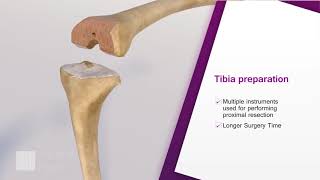 Explainer Video in 3D for Knee replacement surgery by Square Pixel