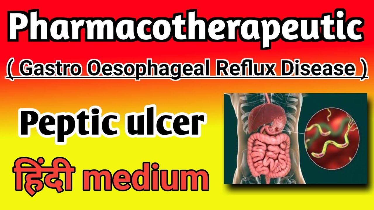 gastrointestinal-disorder-in-hindi-peptic-ulcer-disease-in-hindi