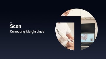 [Scan_Preparation] Correcting Margin Lines