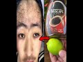 Stop shaving! Here's how to get rid permanently facial, body and pubic hair