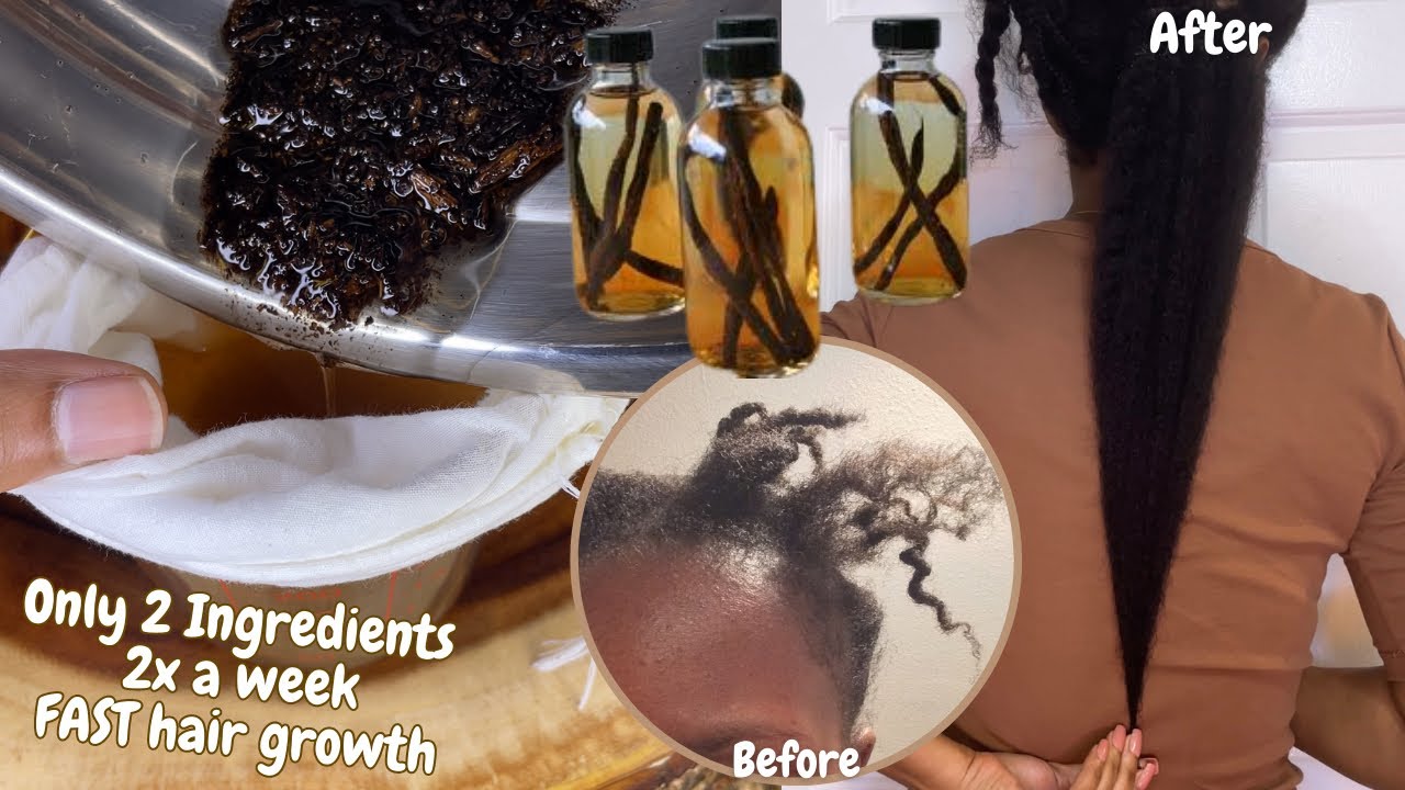 Stop years of slow hair growth, thin edges & dry scalp with this 2