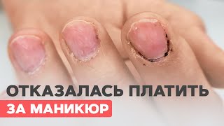 Nails damaged in a nail salon | What is a solution? For and against nail extensions