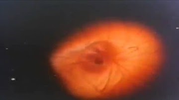 WAIK | ACCU-10XR (Official Video)