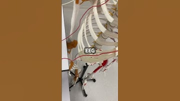 DIY Biomedical Instrumentation for A Robotic Arm: Surface EEG Monitoring System In the MAKING!