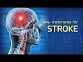 Innovations in the Treatment of Stroke - Health Matters