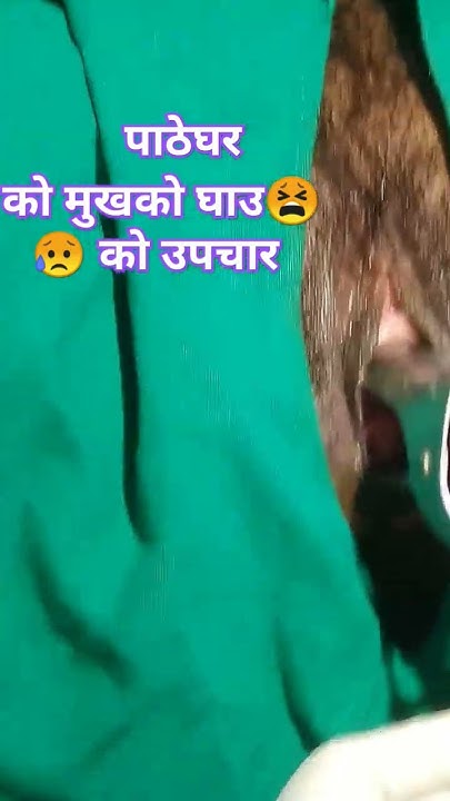 chronic-cervicitis-treatment-during-pregnancy-in-nepal-youtube