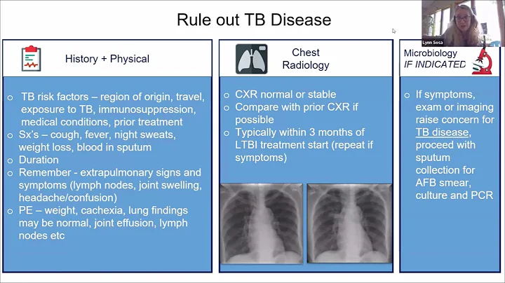 TB 101 Series 2024: Session 4 - Treatment for TB Infection