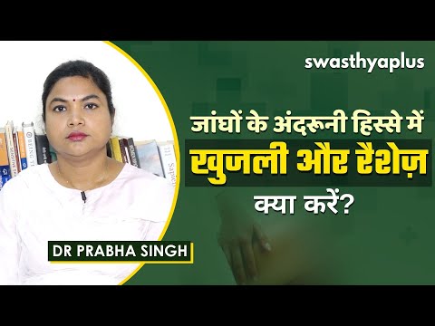 जांघों में रैशेज़ | Heat Rashes/ Jock Itch in Hindi | Symptoms & Prevention | Dr Prabha Singh