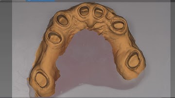 Carestream Dental CS3600 Full arch scan Noritake Porcelain