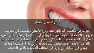 طبيات 60| اسباب تسوس الاسنان رائحة الفم الكريهة والتهاب اللثة وضعف الاسنان من اهم المشاكل