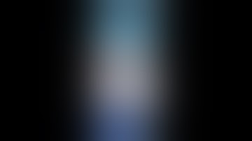 SICOT PIONEER Webinar - Acute Shortening in the Management of Long Bone Deformities