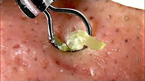 Satisfying Video Face Skin Care and Relaxing Sleep Music (afternoon 05/11/2019)