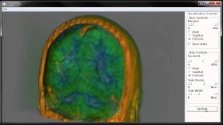 MRI Viewer (using VTK)