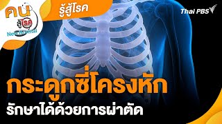 กระดูกซี่โครงหักรักษาได้ด้วยการผ่าตัด | รู้สู้โรค | คนสู้โรค