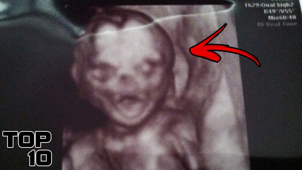 Top 10 Scary Ultrasound Stories You WON'T Believe YouTube