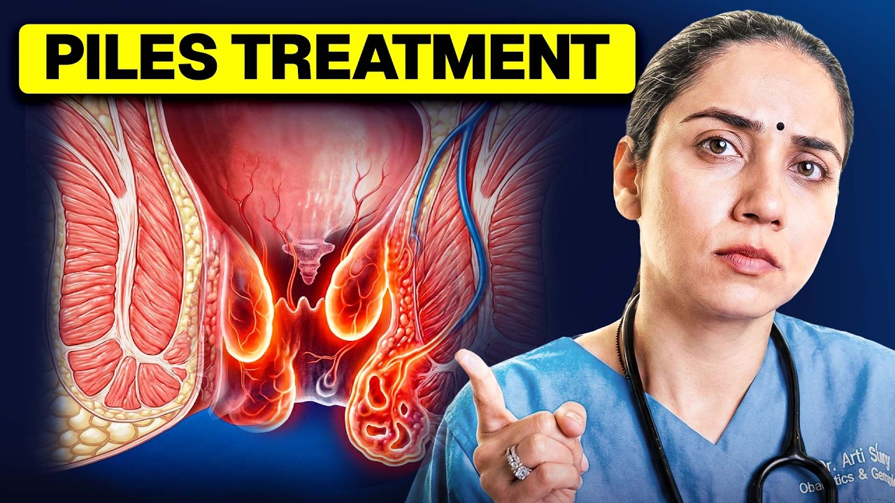 How To Get Rid Of Hemorrhoids | Hemorrhoids Treatment