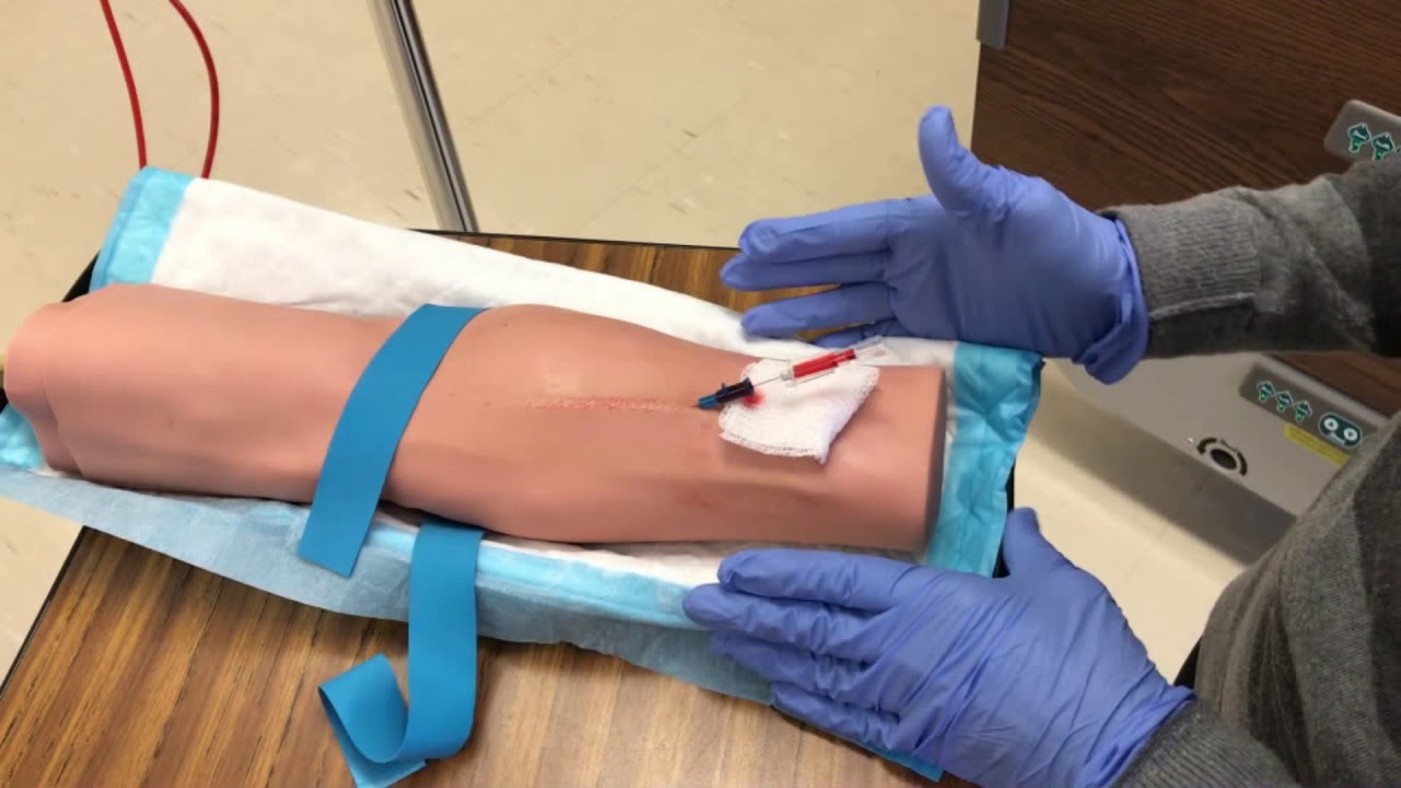 CAPSULE VIDÉO Insertion d'un cathéter intraveineux