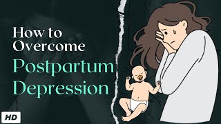 Postpartum Depression