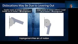 Handling the Unstable RSA: Prevention & Management Mark A. Frankle, MD | SDSI Shoulder Course 2021