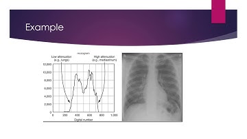 Histogram Analysis Vid