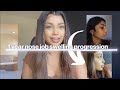 1 year nose job (rhinoplasty) swelling progression - Dr.Resit Burak Kayan