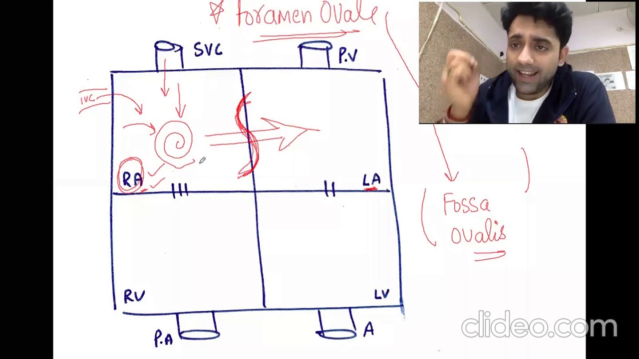 FETAL CIRCULATION BY DR.ANAND ( FOR FULL PEDS - DOWNLOAD MY MEDMIRACLE APP )