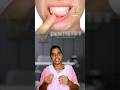 Understanding Intentional Root Canal Treatment and Fixed Partial Dentures at Dr Neemz Dentistry