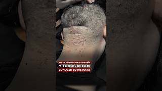 Se contagió en una peluquería y todos deben conocer su historia