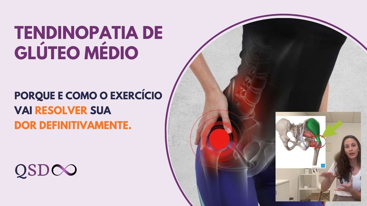 Por que e como o exercício vai resolver a sua tendinopatia de glúteo médio?