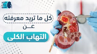 التهاب الكلي | كل ما تريد معرفته عن التهاب الكلى