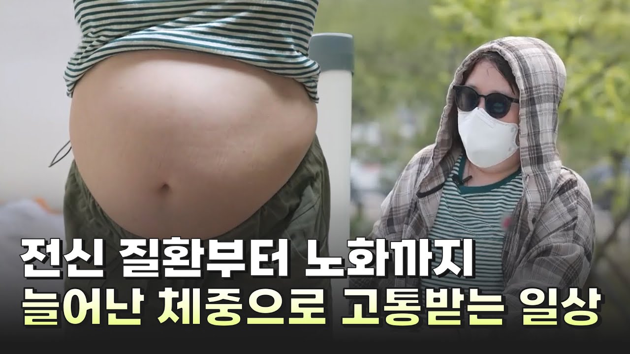 전신 질환부터 노화까지...늘어난 체중으로 고통받는 일상 #28청춘