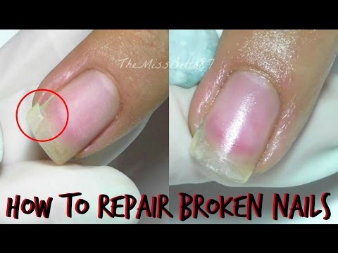 Come riparare un'unghia rotta - How to repair broken nails