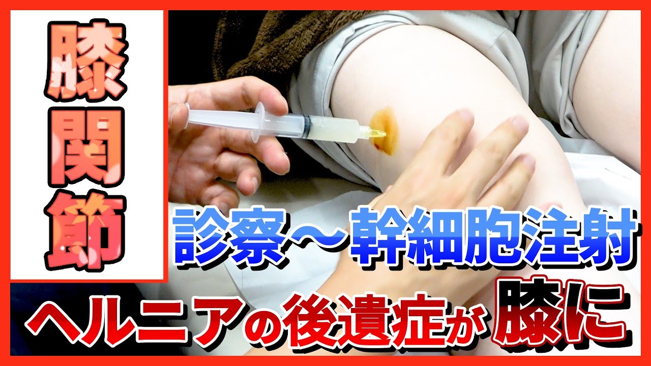 膝 が 痛い 原因 40 代