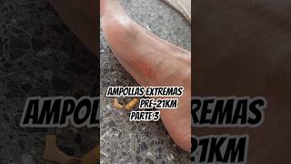EL PRECIO DE SUPERARSE: AMPOLLAS DE LUJO 😰 🩹 🦶🏽 Parte 3 #mim2026 #maraton #Noseabandona